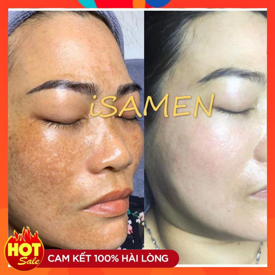 Kem ức chế nám mảng ISAMEN sáng da, căng mướt da