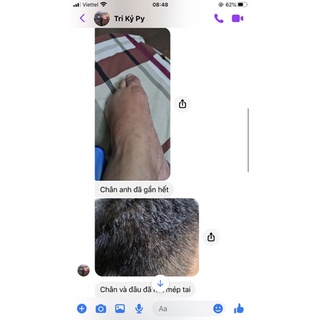 thảo dược bôi bạch biến