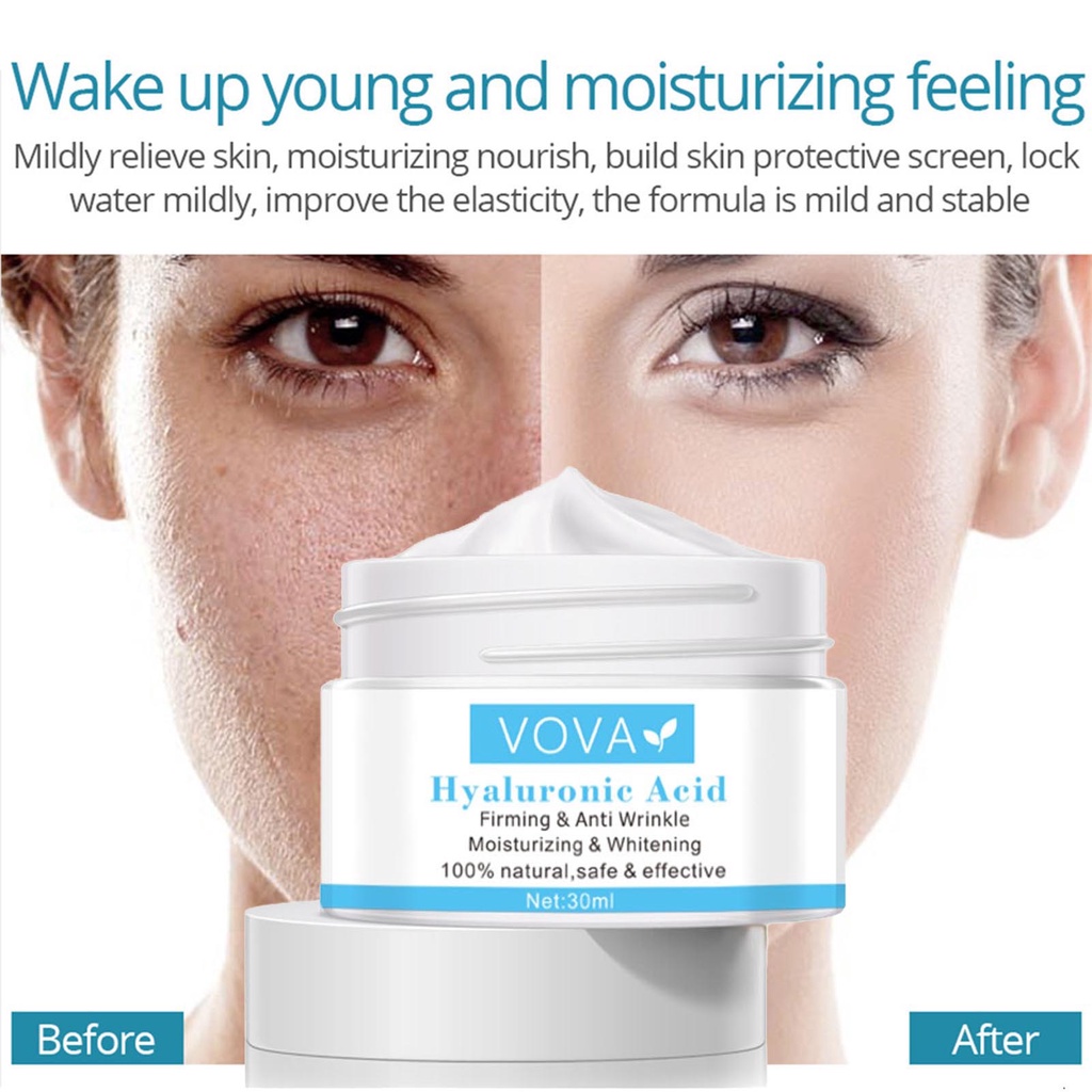 [Hàng mới về] Kem dưỡng da mặt làm trắng da chống lão hóa và se khít lỗ chân lông 30ml
