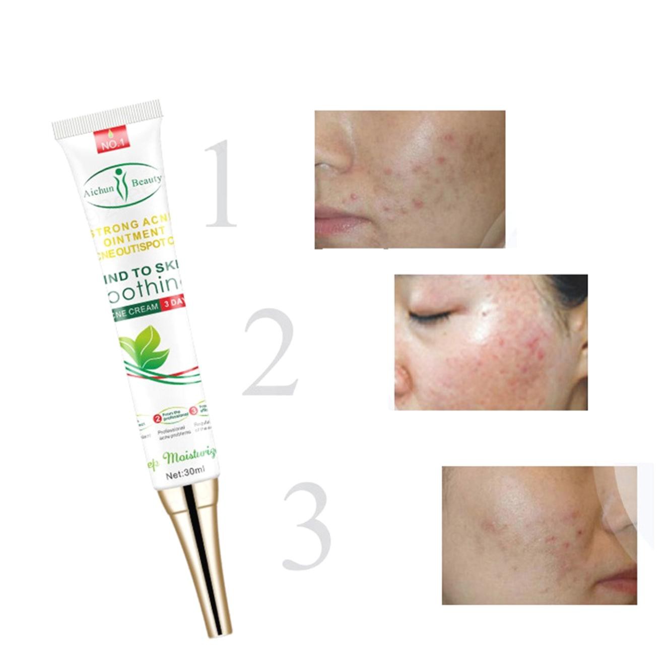 (Hàng Mới Về) Gel Hỗ Trợ Giảm Sẹo Chăm Sóc Da Tự Nhiên Aichun Beauty