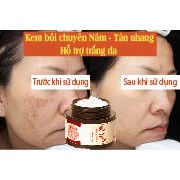 Kem bôi Nám - Tàn Nhang - Trắng da (Cực hiệu quả)