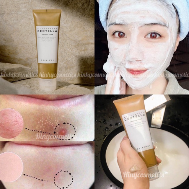  Sữa rửa mặt rau má Madagascar Centella Skin1004