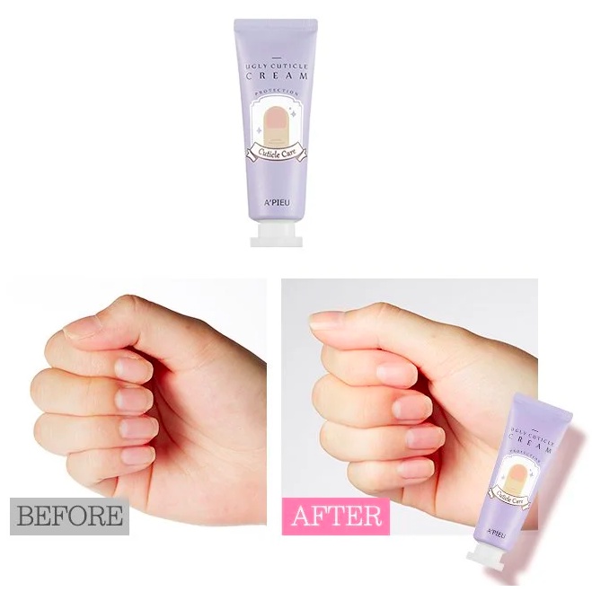 MBC Kem dưỡng móng và tẩy tế da chết cạnh móng APIEU Ugly Cuticle Cream