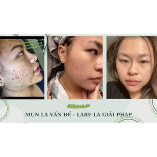 30ml serum Thanh Dược Lare