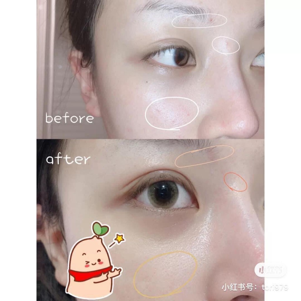 Kem làm lành da liền sẹo Avene cicalfate+ repairing protective cream 40ml- 100ml