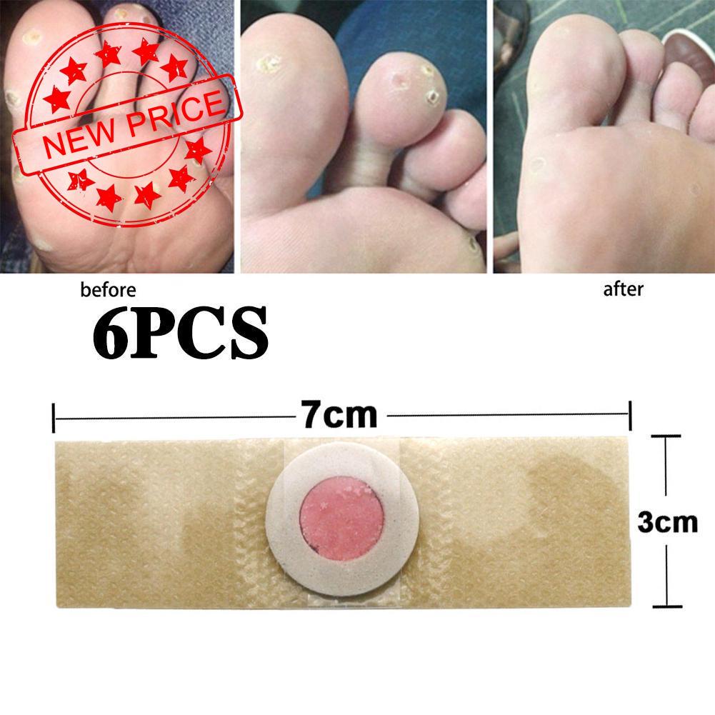 Bộ 6 Miếng Dán Trị Vết Chai Cứng/Bấm Dễ Sử Dụng E5L3