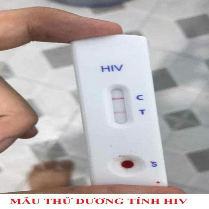 Que thử nhanh HIV tại nhà Fastep USA kết quả chính xác đến 99%