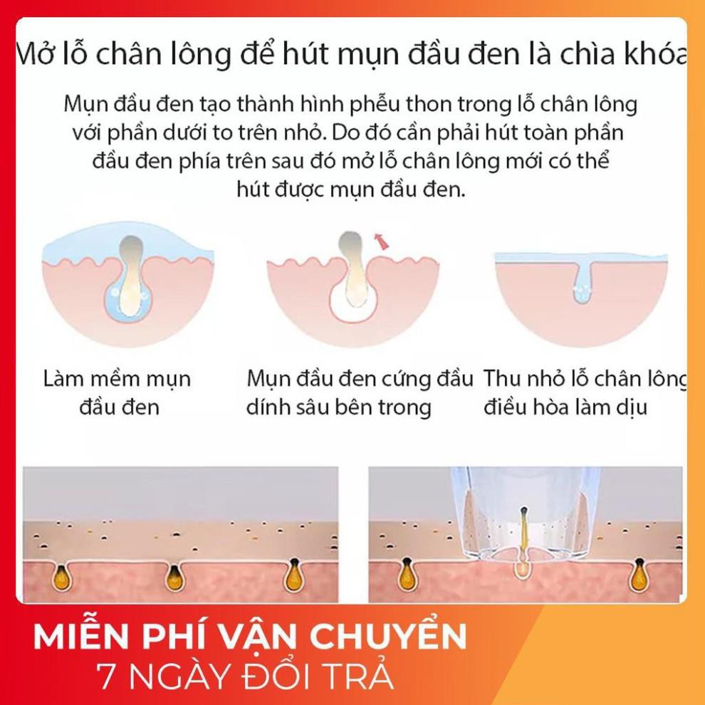 [FREESHIP] Máy Hút Mụn Đầu Đen - Bản Quốc Tế