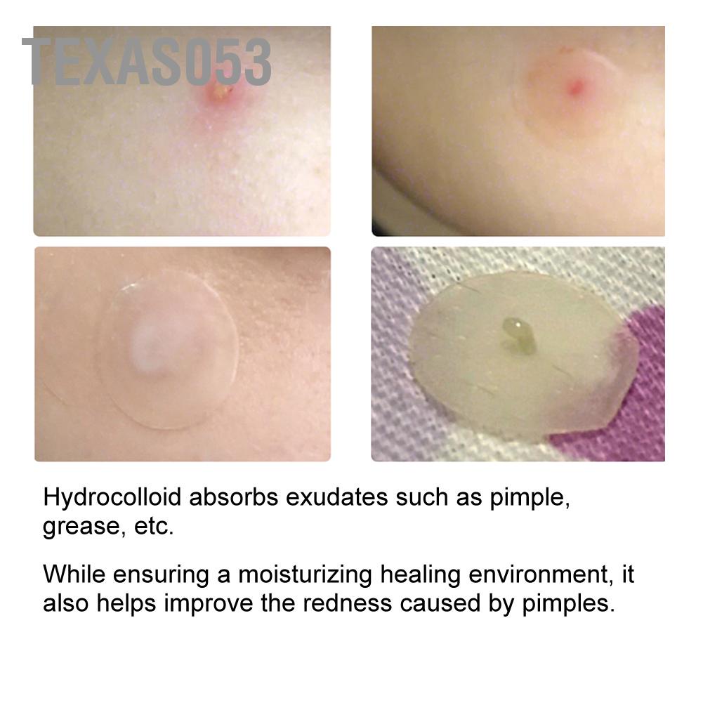 [Hàng mới về] 36 Miếng dán trong suốt sử dụng che khuyết điểm vùng mụn nhọt Texas053