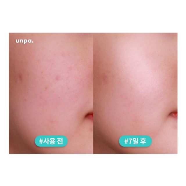 Tinh Chất Dưỡng Trắng Da căng bóng Chống Lão Hóa Coreana AMPLEN Peptide Shot Ampoule 2x
