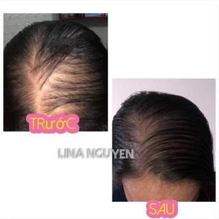 Bộ sản phẩm chăm sóc tóc Bưởi Rừng TB.D’aboard