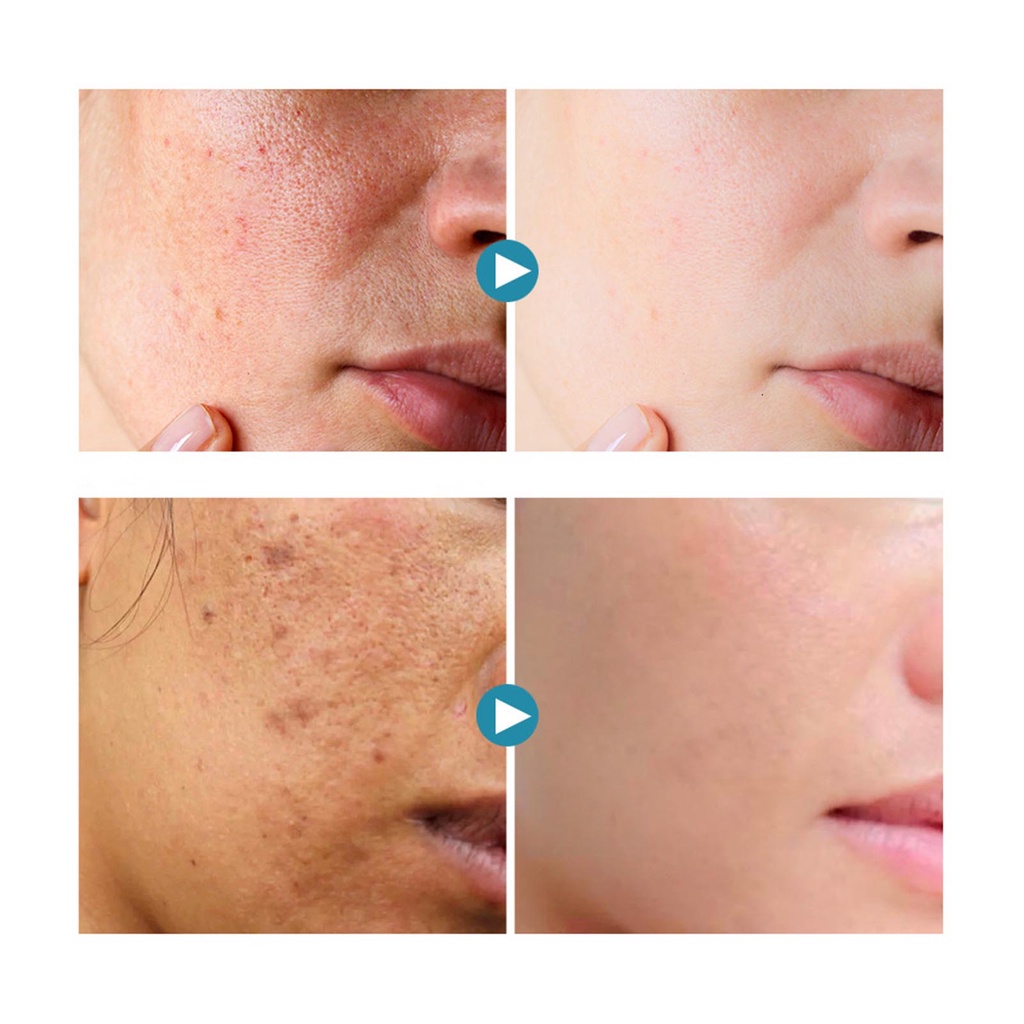 [Hàng mới về] Kem dưỡng da mặt làm trắng da chống lão hóa và se khít lỗ chân lông 30ml