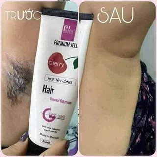 Kem Triệt Lông Cherry