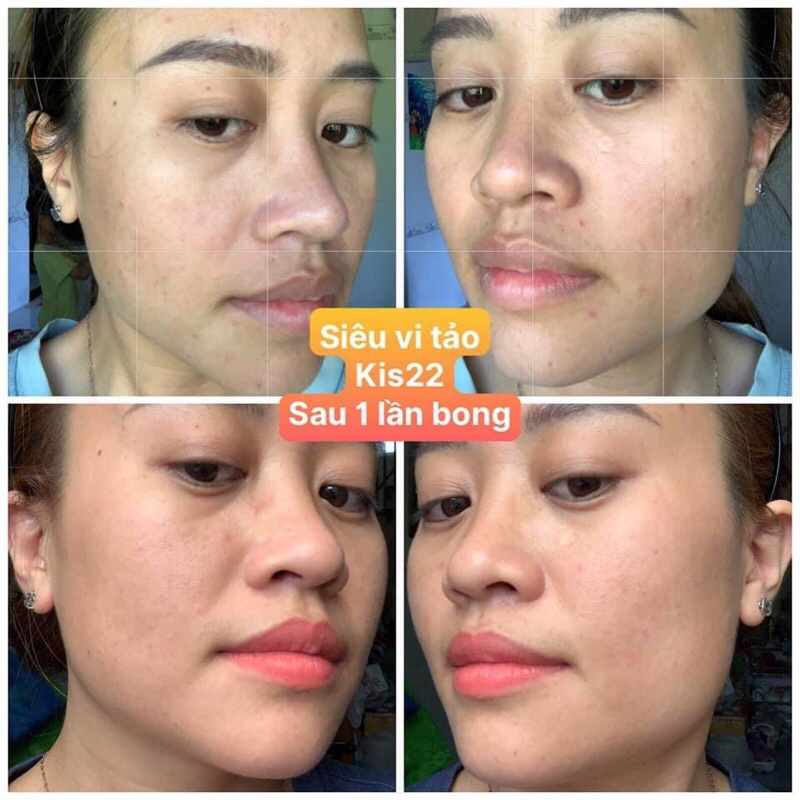 Serum tái sinh da siêu vi tảo Nhật | BigBuy360 - bigbuy360.vn