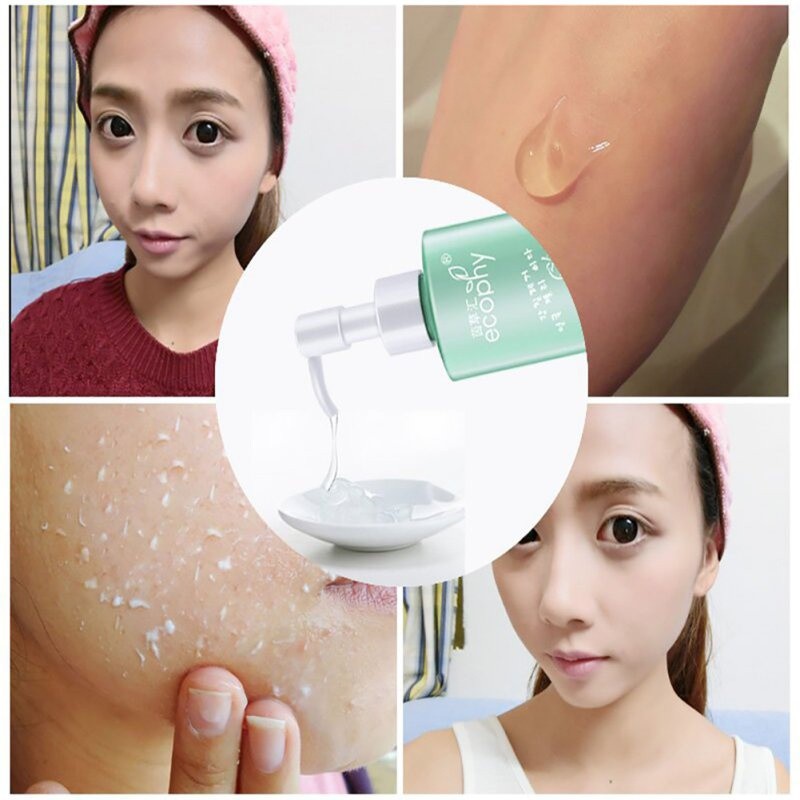 Kem tẩy tế bào chết làm sạch sâu da mặt ECOPHY | BigBuy360 - bigbuy360.vn