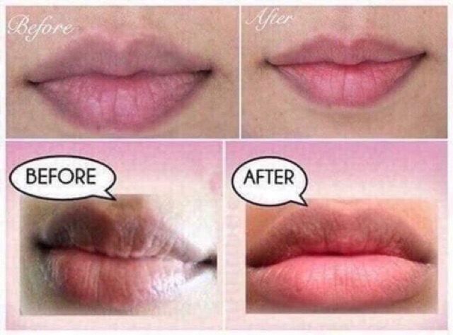 Dưỡng Môi Thâm Loang ULTRA LIP Kích Màu Sau Phun Untra Lip