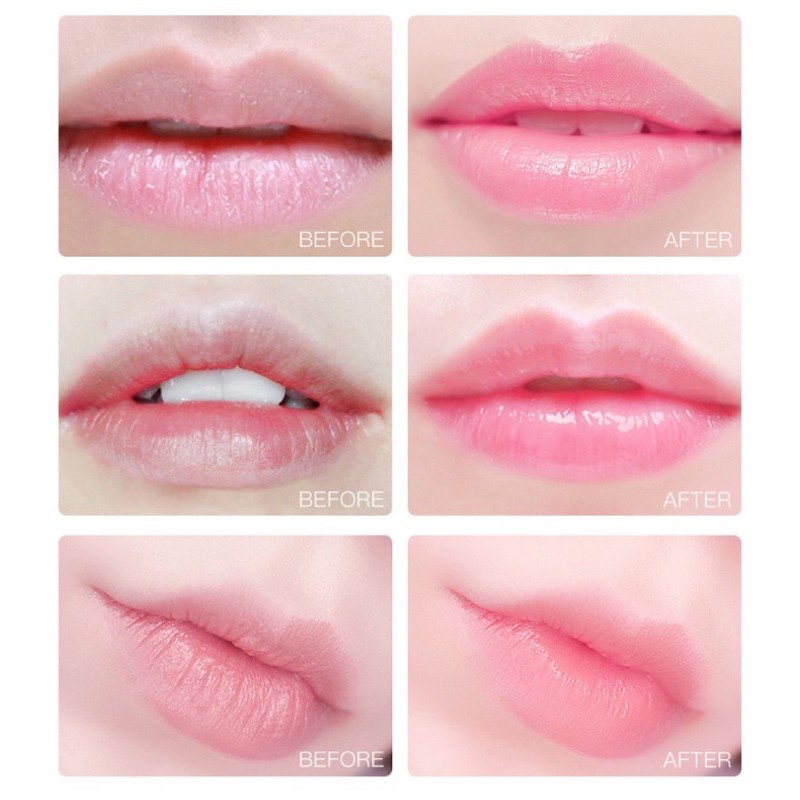 Hộp 20 miếng mặt nạ môi RUOALL chất lượng cao 150g