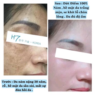 Serum Retinol Huyền Cò