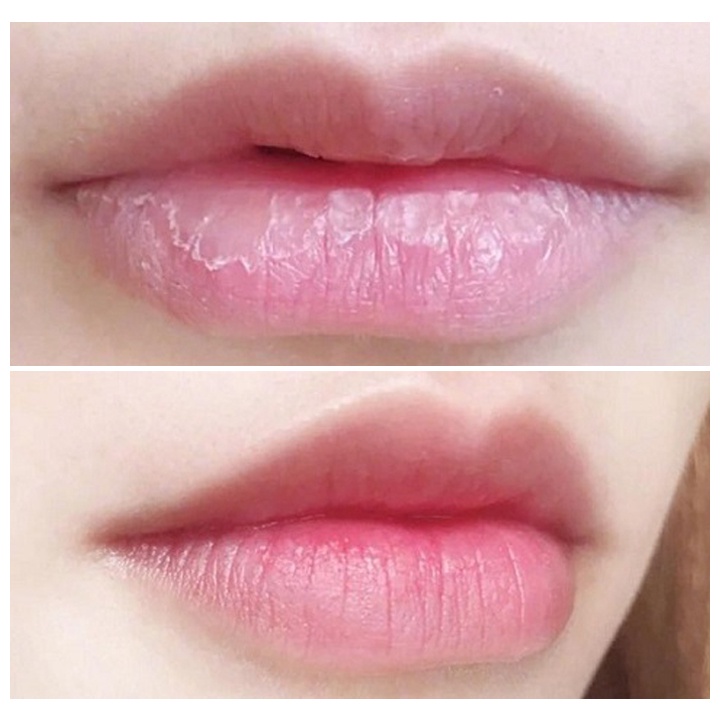 Son Dưỡng Môi Collagen Giảm Thâm, Kích Màu Môi Sau Phun Xăm, Dưỡng Môi Căng Bóng, Mềm Mượt