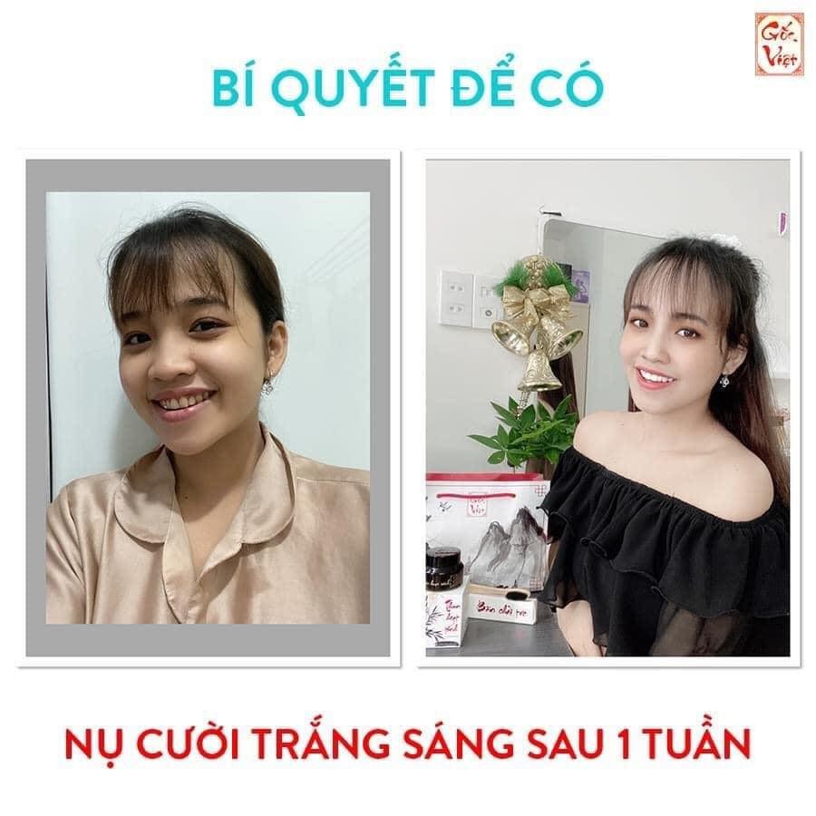 [Tặng 2 QUÀ-CHÍNH HÃNG-+Freeship] THAN HOẠT TÍNH TRẮNG RĂNG GỐC VIỆT, Khử Hôi Miệng, Răng Trắng Tự Nhiên sau 3-5 ngày