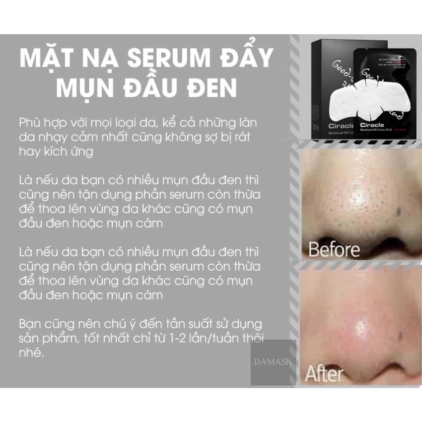 Miếng dán đẩy mụn đầu đen Goodbye Black Head Ciracle