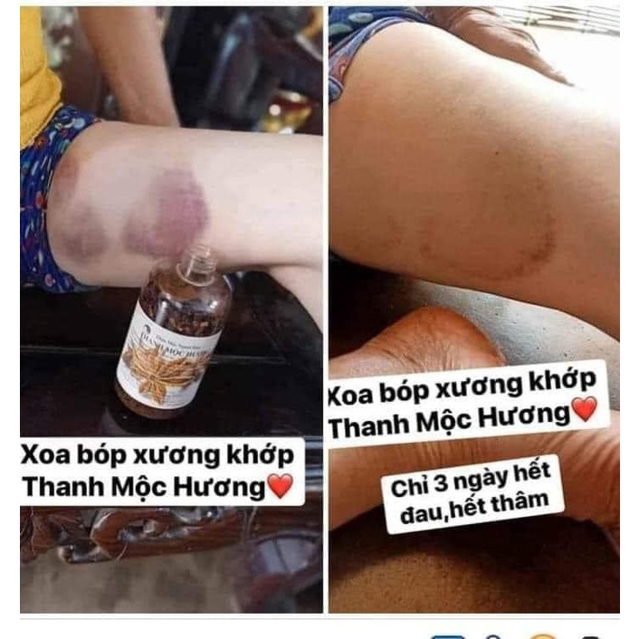 Thảo Mộc xoa Bóp Thanh Mộc Hương - Xóa Tan Mọi Cơn Đau Xương Khớp