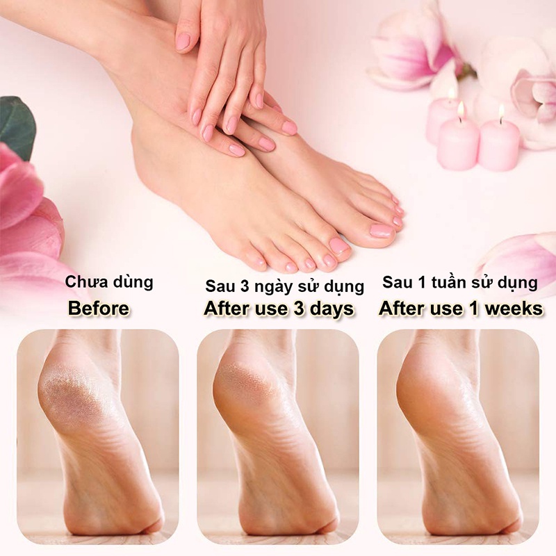 Máy Chà Gót Chân Xiaomi Doco F002 Tặng 2 Đầu Chà, Kem Dưỡng, 2 Chế Độ - Máy Cạo Gót Chân Xiaomi Loại Bỏ Vết Chai Chân