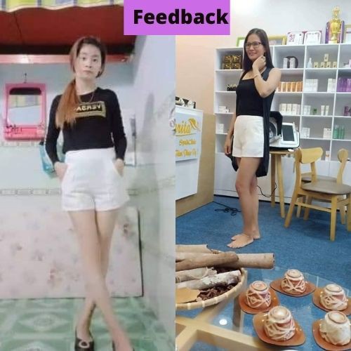Quần Short Nữ Dáng A 🍀FRRESHIP🍀Quần Sooc Nữ Cạp Cao Tôn Dáng Vải Tuyết Mưa Cao Cấp | BigBuy360 - bigbuy360.vn