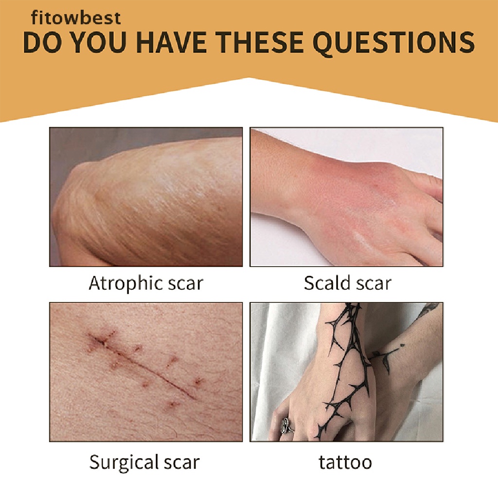 Ftvn Skin Invisible Concealer Patch Sticker Breathable Tattoo Scar Cover Waterproof QDD