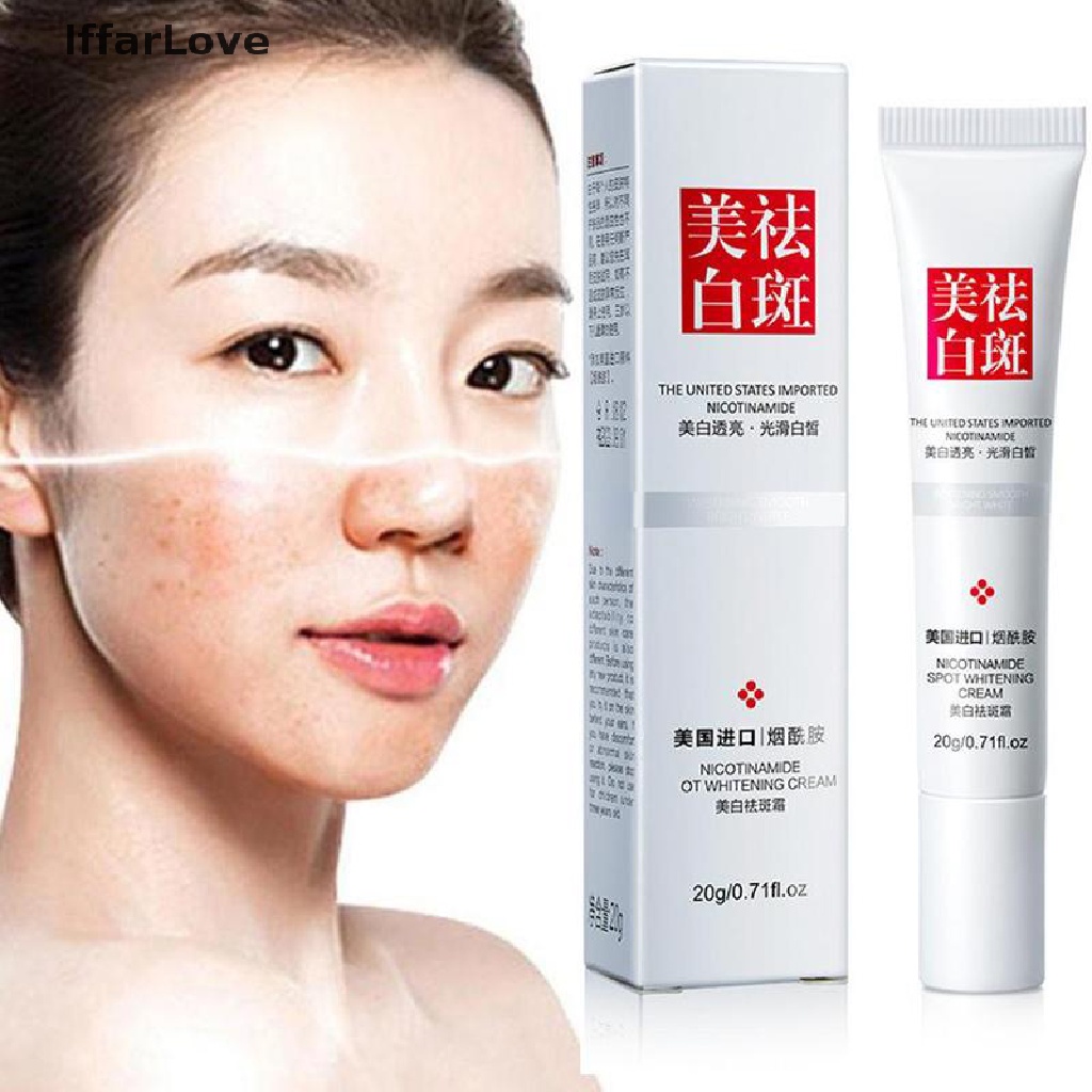 Kem Dưỡng Trắng Da Xóa Tàn Nhang Hiệu Quả