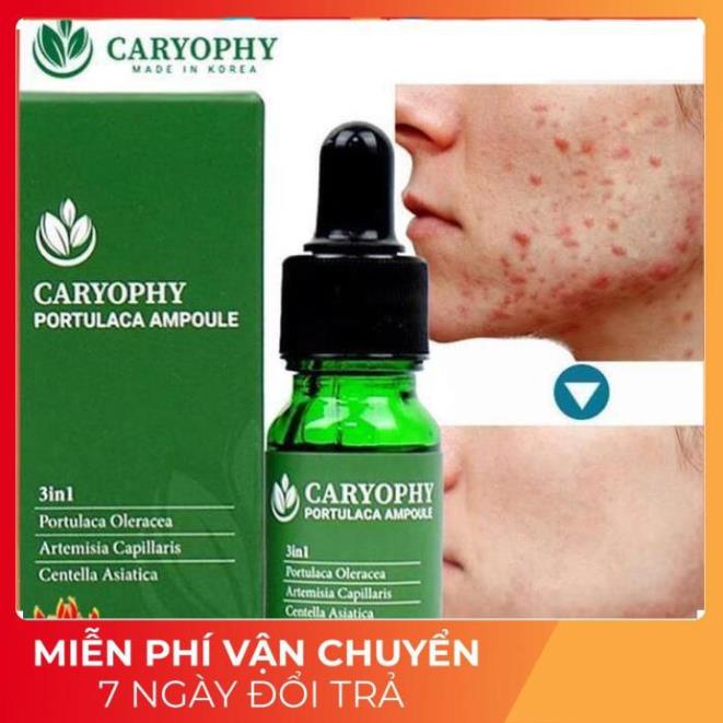 Sỉ-  Serum ngăn ngừa mụn và thâm Caryophy Chính Hãng - Serum Mụn Ngăn Ngừa Mụn Ẩn,Mụn Đầu Đen