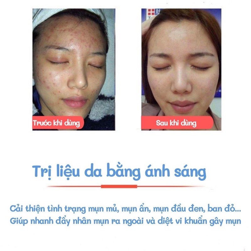 MASSAGE MẶT + LÀM SẠCH + TRẺ HÓA] Máy massage mặt - mát xa mặt, làm sạch, trẻ hóa - Chăm sóc da mặt đa năng