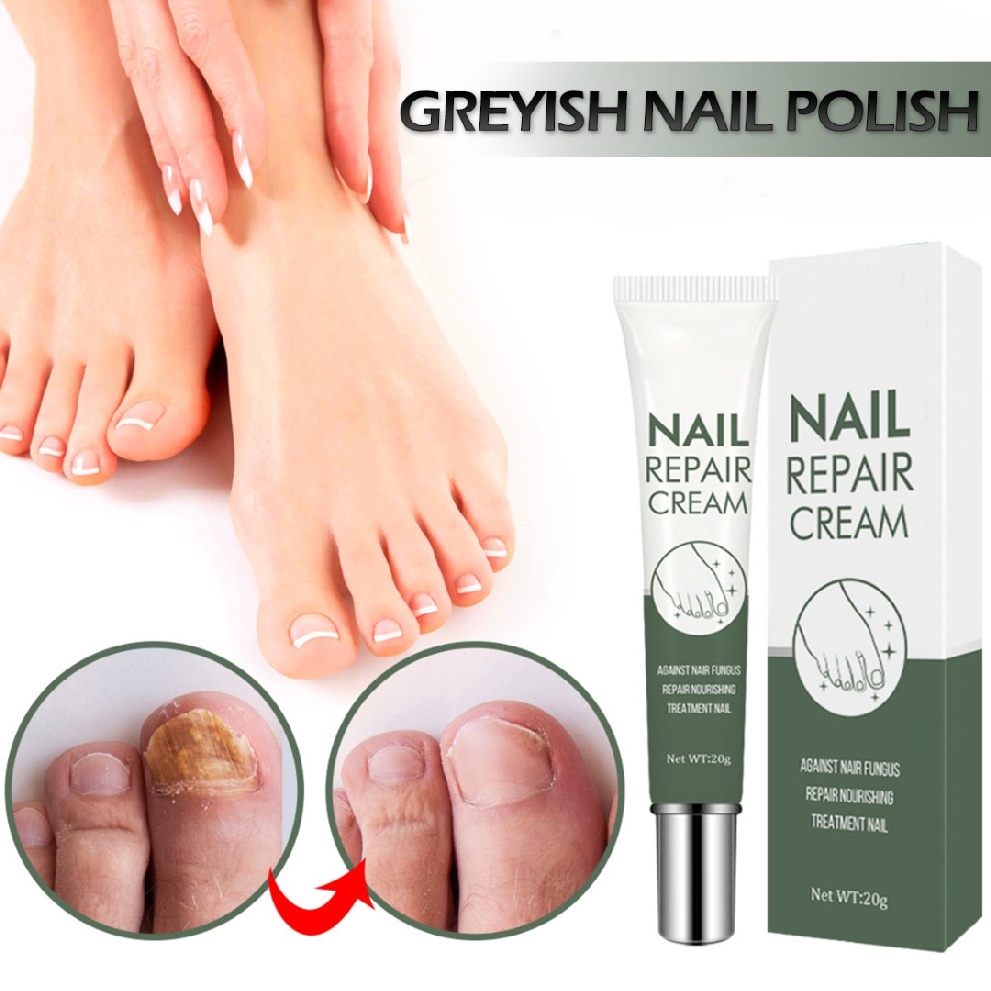 [Hàng mới về] Kem dưỡng phục hồi móng bị hư hỏng mất màu dành cho chăm sóc móng chân 20g