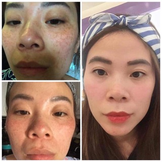 KEM TÁI TẠO CHAMOMILESKILL