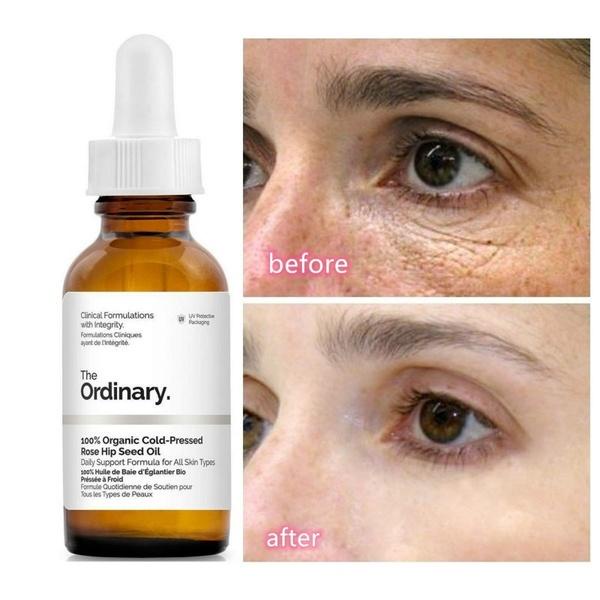 [CANADA- Full Bill] Dầu dưỡng da tạo đàn hồi + tái tạo tế bào 100% Organic Cold-Pressed Rose Hip Seed Oil - The Ordinary