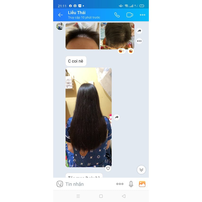 [Chính hãng] Dầu gội thảo mộc MẸ KEN-Dầu Gội Thảo Mộc chiết xuất thiên nhiên 100%- 250ml | BigBuy360 - bigbuy360.vn