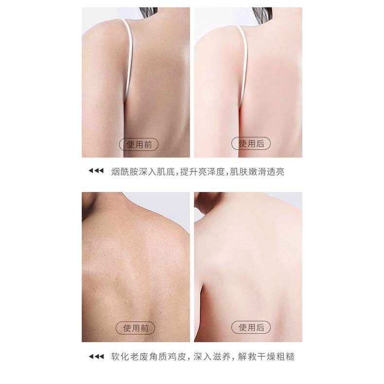 Hộp Tẩy Tế Bào Chết Toàn Thân 230g Làm Trắng Da Cấp Ẩm