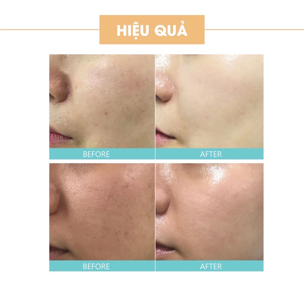 Bộ sản phẩm dưỡng trắng da mặt Acosmetics: Sữa rửa mặt trà xanh + Kem face pháp