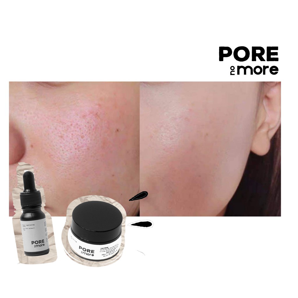 Serum nhỏ lỗ chân lông - giảm mụn đầu đen vùng MŨI PORE NO MORE