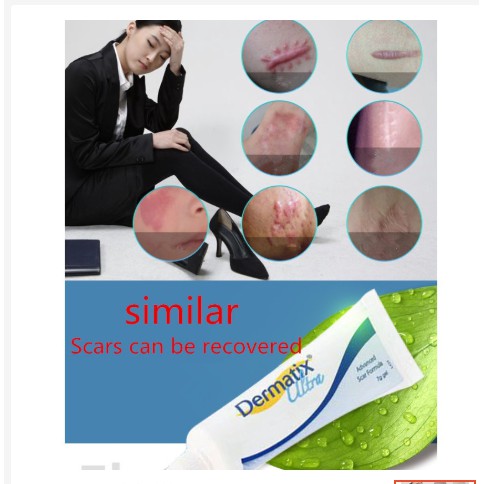 DERMATIX United states states Kem Tẩy Sẹo Phục Hồi Da Hư Tổn 15g Bằng silicone gel