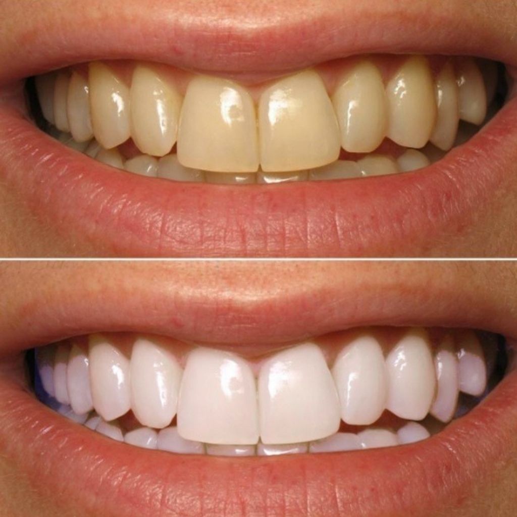 Kem Đánh Răng Bạc Hà Eucryl Toothpaste Giúp Tẩy Trắng, An Toàn Tuyệt Đối Cho Răng 62g