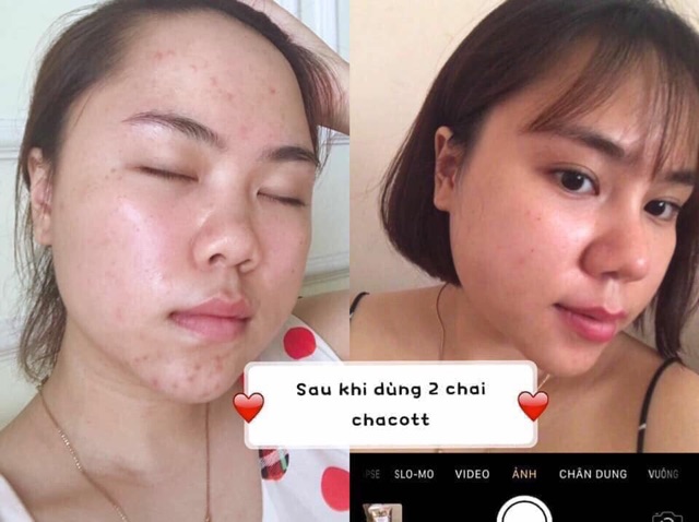 Nước tẩy trang Chacott micellar water