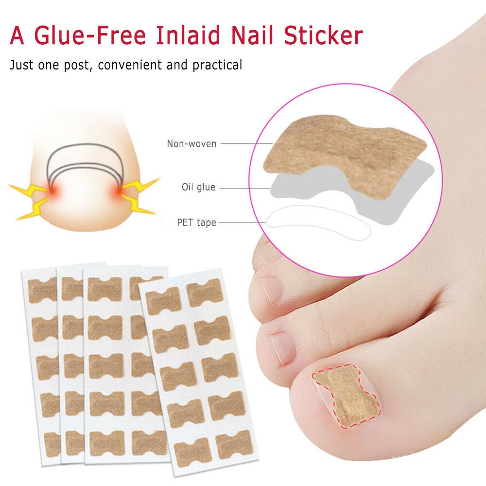10PCS Non-Glue Toenail Patch Ingrown Toenail Correction Pedicure Tool