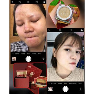 CAO MỤN SÂM ĐỎ 36 VỊ