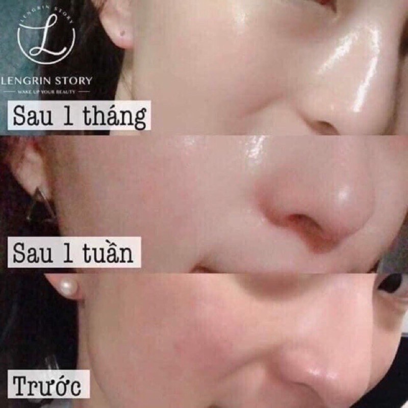Serum Diadermine Đức, viên nang dưỡng da bổ sung collagen tươi làm trắng, chống lão dạng huyết thanh, hiệu quả tức thì