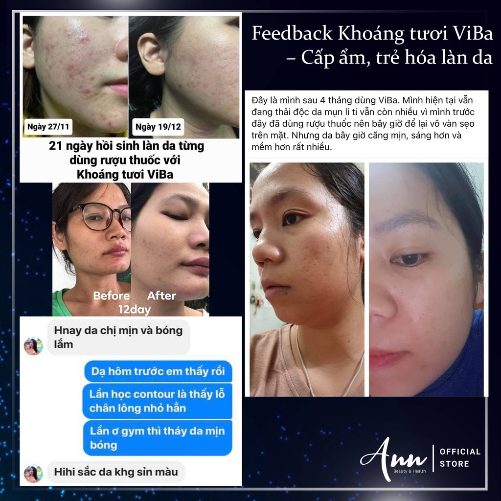 Xịt khoáng tươi ViBa 250ml cấp ẩm, dưỡng da, làm dịu, cân bằng da – Đại lý chính hãng Annshop | BigBuy360 - bigbuy360.vn