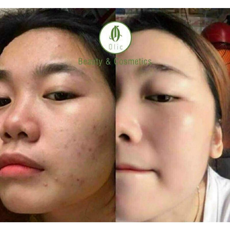 [CHÍNH HÃNG] KEM BƠ OLIC CẤY TRẮNG NUÔI DA MẪU MỚI | BigBuy360 - bigbuy360.vn
