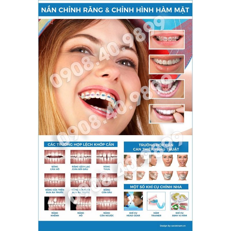 Tranh nha khoa các chủ đề: Dịch vụ, giải phẫu, implent....chất liệu CÁN BÓNG