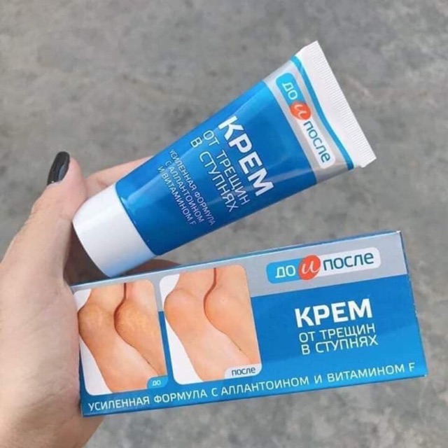 Kem trị nứt gót chân nga