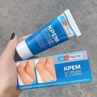 Kem trị nứt gót chân nga
